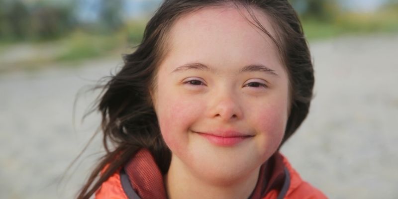 An adorable child with down's syndrome