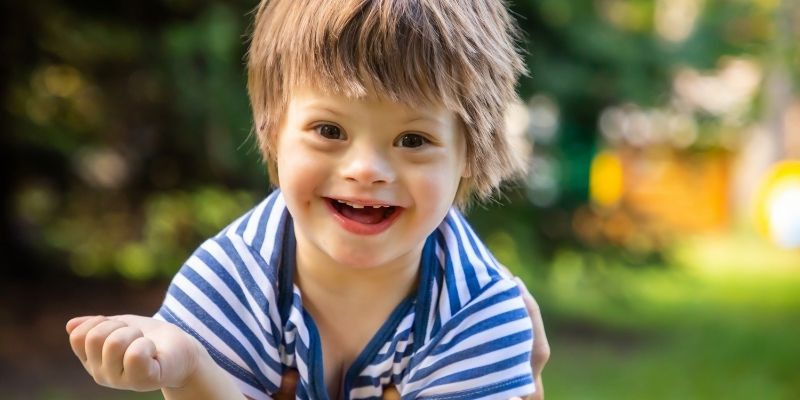 An adorable child with phace syndrome